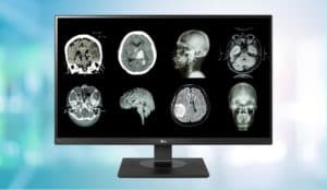 Niche monitors: screens in the medical world